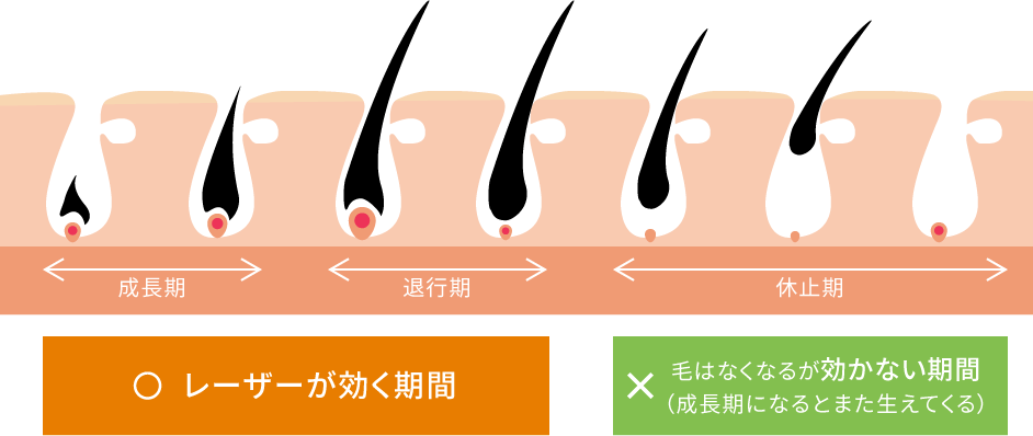 毛周期のイメージ図